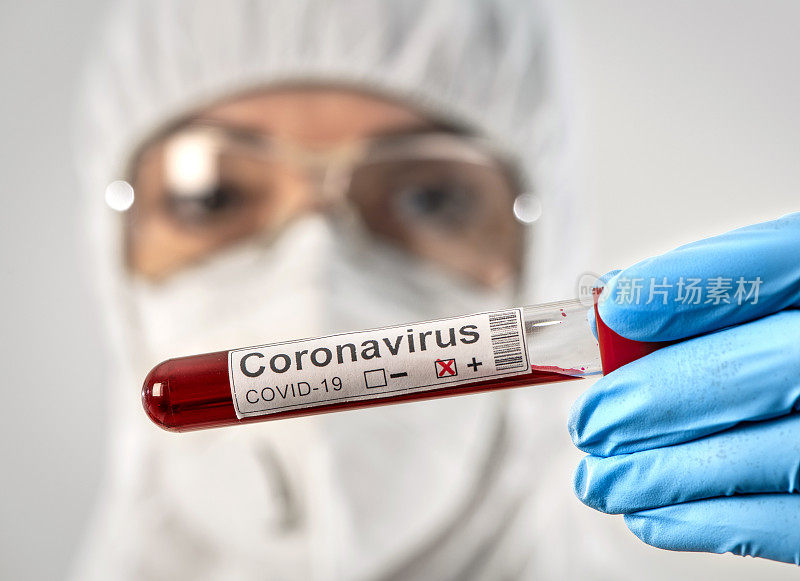 新型冠状病毒暴发疫情检测试剂盒检测冠状病毒COVID - 19医学样本